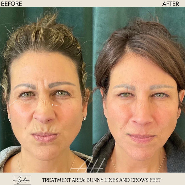 Descriptive Alt Text