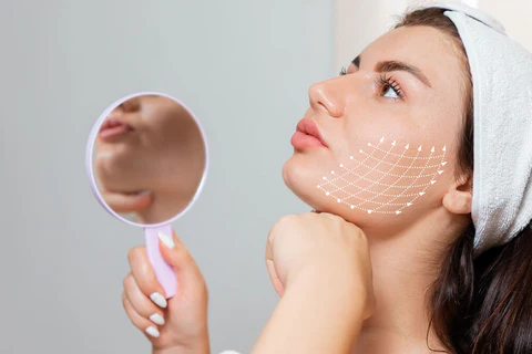 woman showing where pdo threads would lift the face