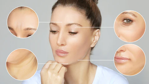image showing treatment areas on a face