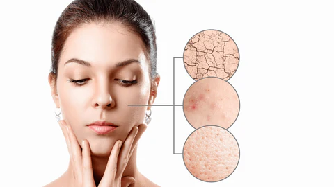 image of a woman's face with examples of treatable skin conditions